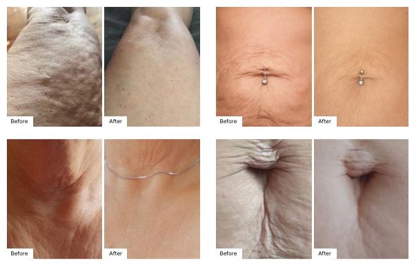Real Results from users of Firm Cream and Sunless Tanner